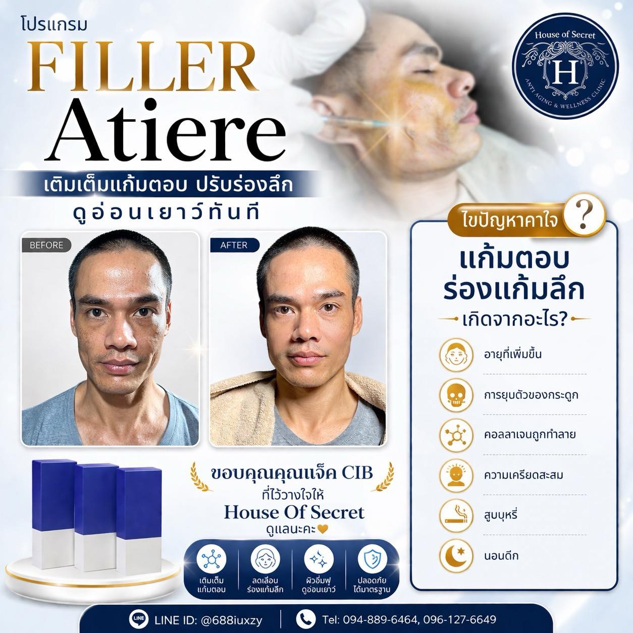 รีวิวโปรแกรมฉีด Filler 4 CC ในการปรับรูปหน้า