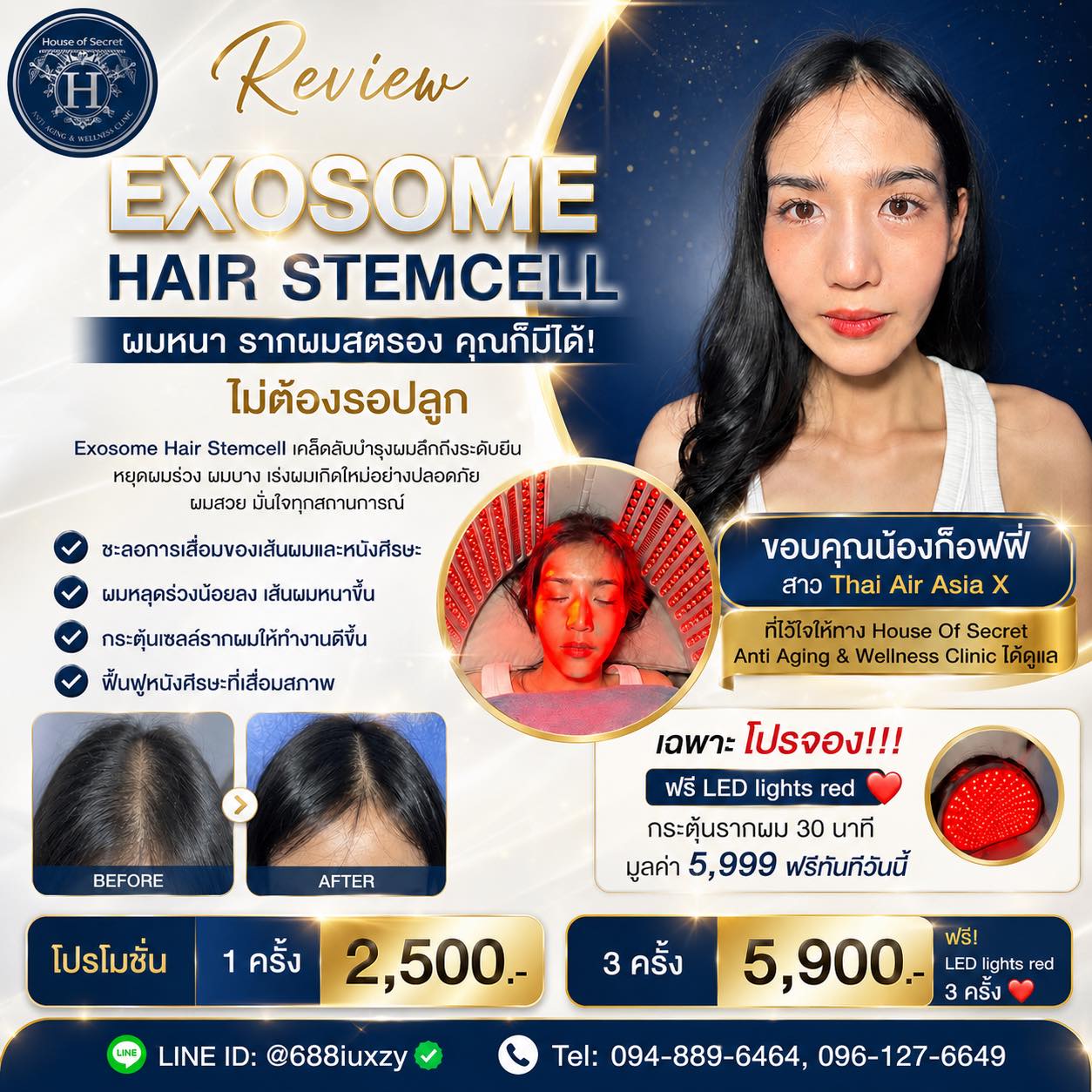 Exosome Hair Stemcell