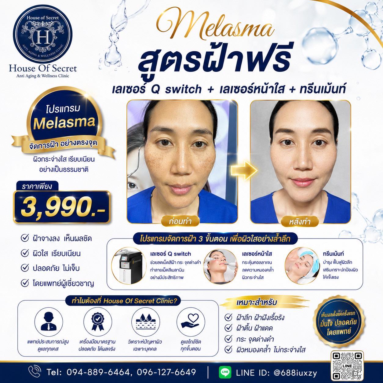 โปรแกรม Melasma clear สยบปัญหาฝ้ากระ