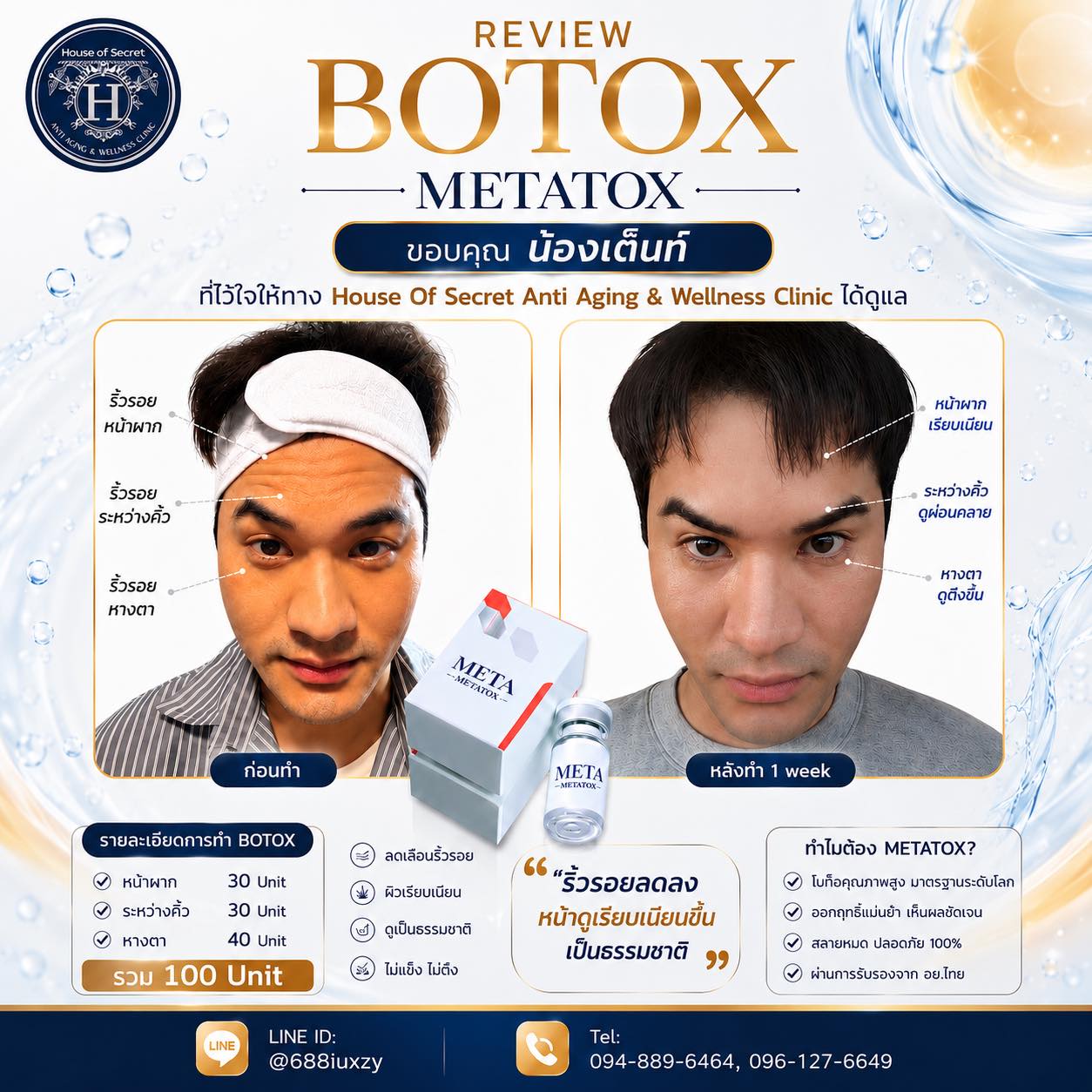  ขอขอบคุณ น้องเต็นท์ นายแบบสุด Hot ที่เลือก Metatox โบตัวใหม่ตัวปัง