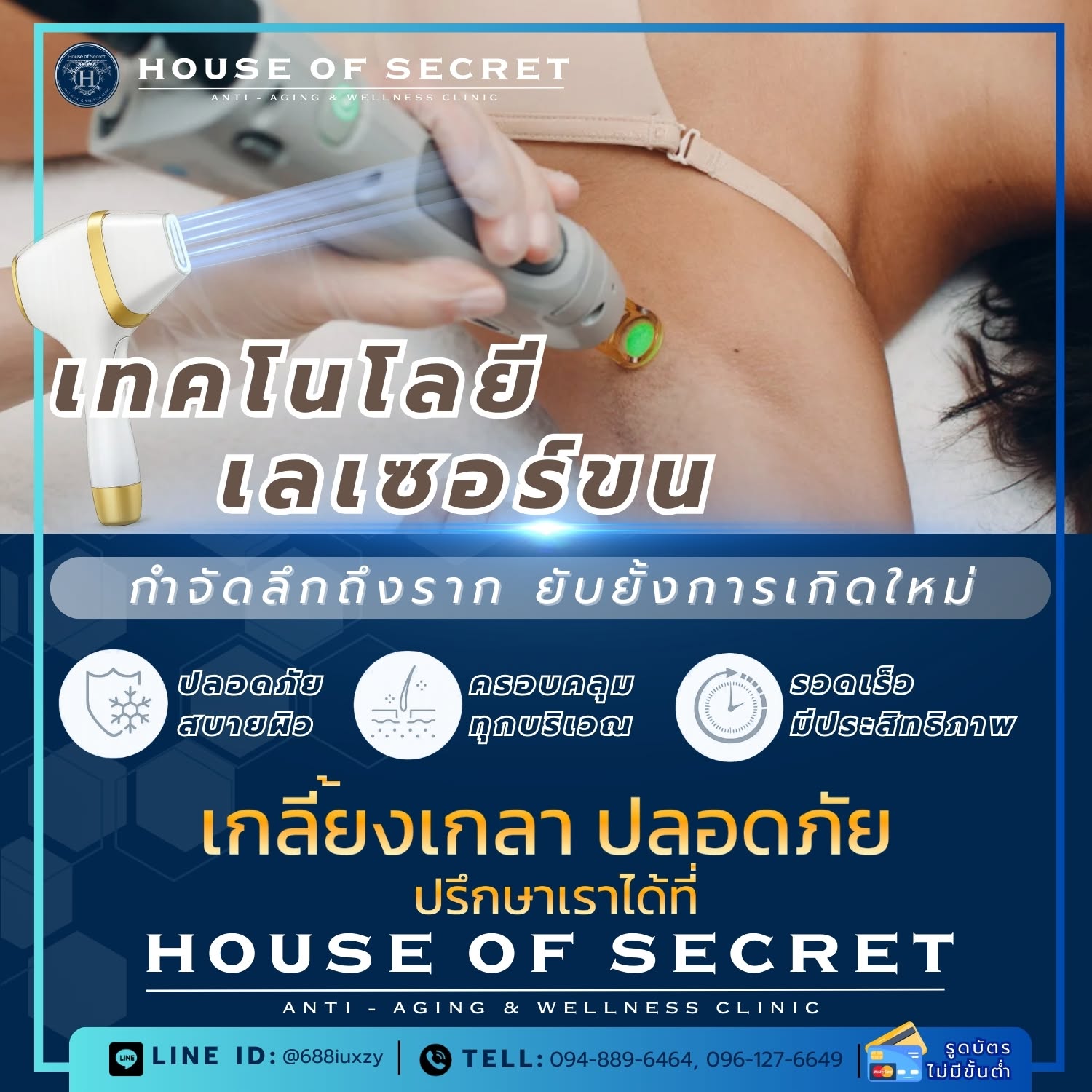 เลเซอร์