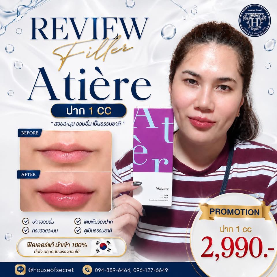 เติมความละมุน ปรับสมดุลใบหน้า! กู้หน้าโทรมให้กลับมาสดใสด้วยฟิลเลอร์ ปากละมุน