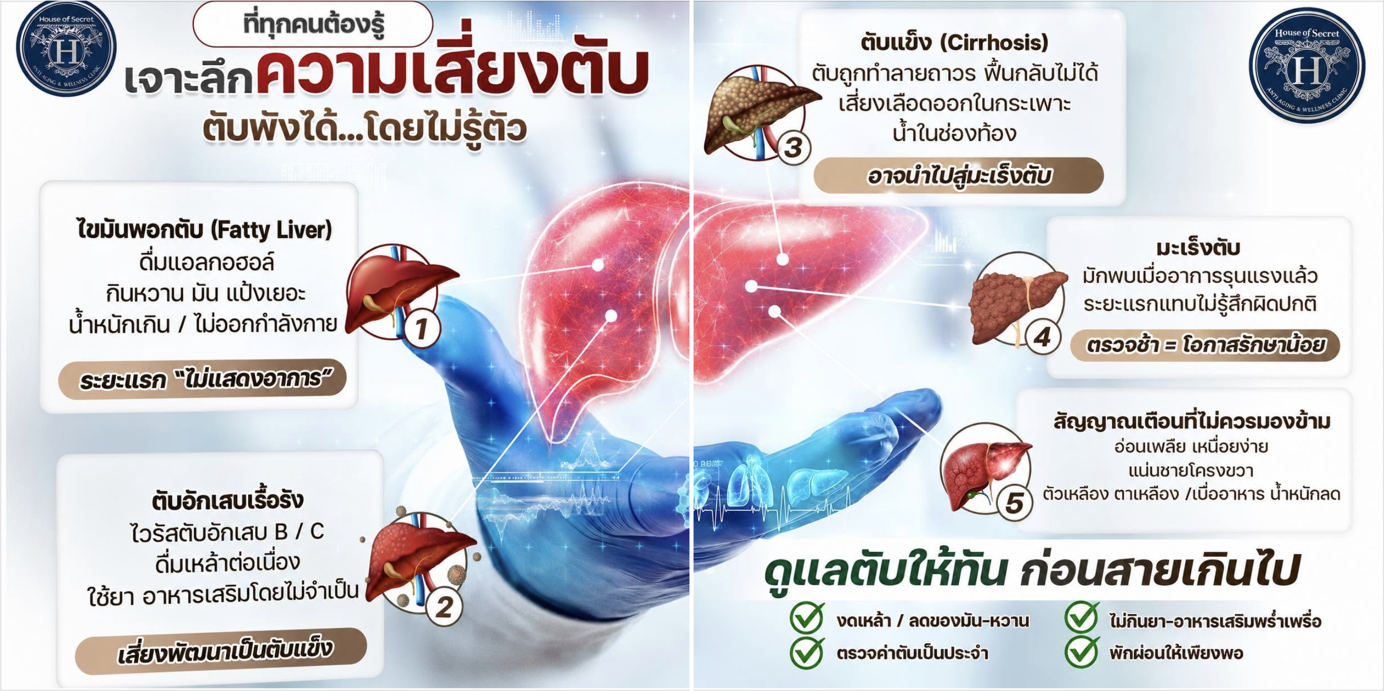 เจาะลึกความเสี่ยง “ตับ”  ตับพังได้…โดยที่เราไม่รู้ตัว