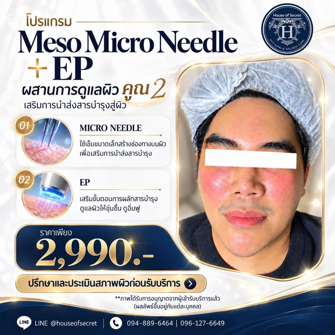 โปรแกรม Meso Micro Needle + EP ดูแลผิว 2 ขั้นตอน ราคาเพียง 2,990 บาท